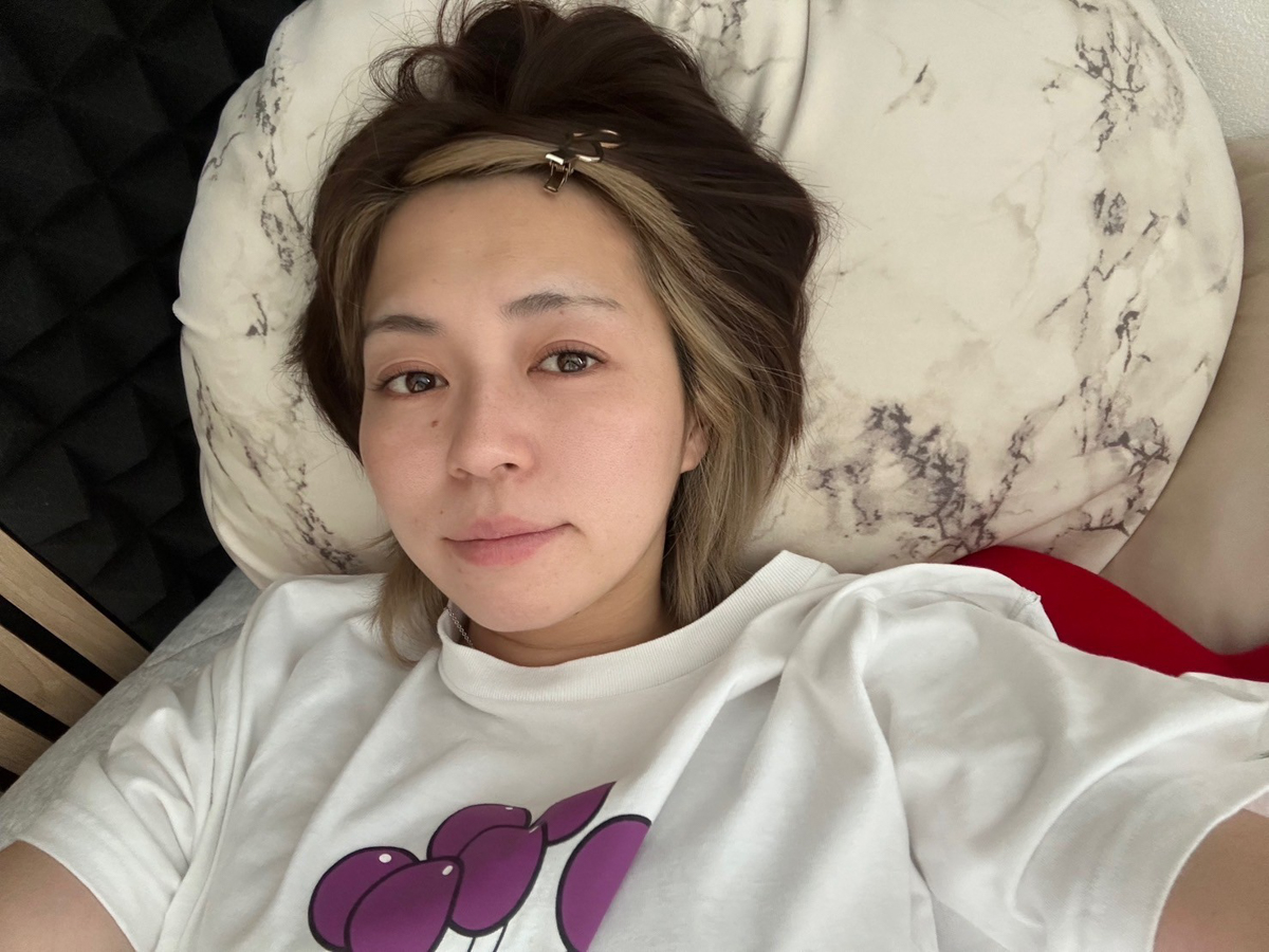 アスカアイクリニック_オネーサン1ヶ月後検診-73