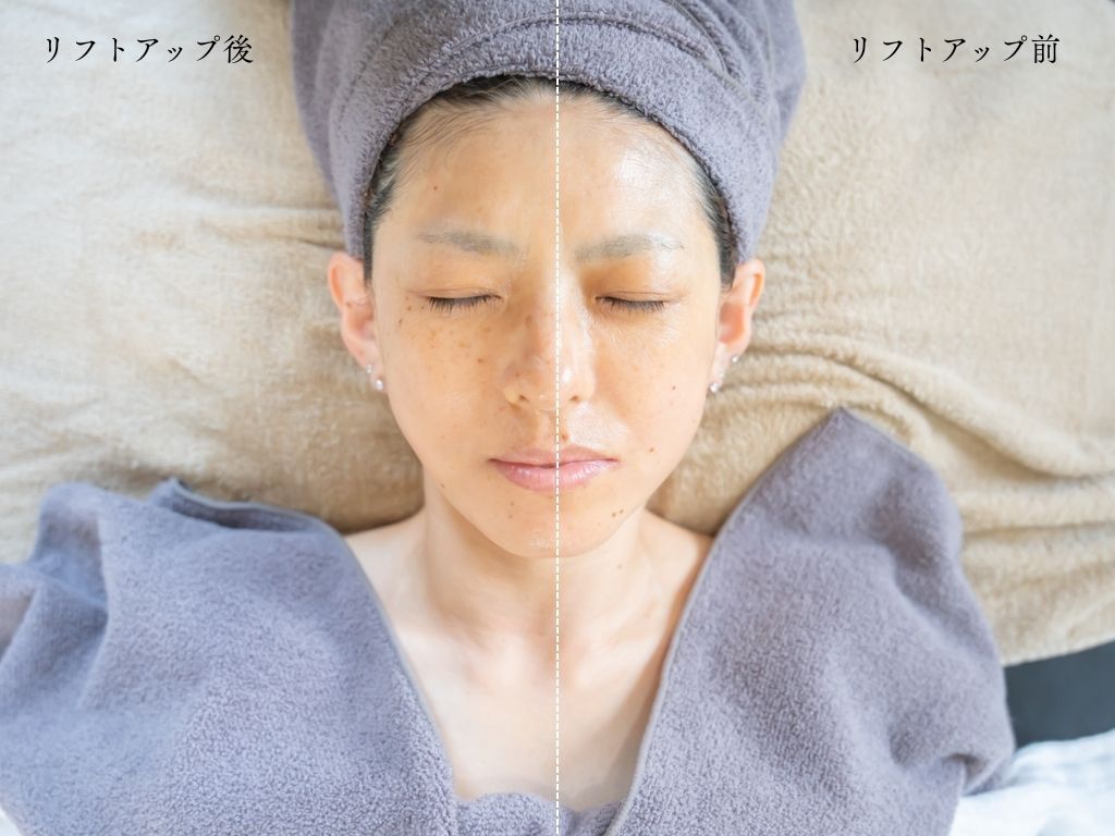 リフトアップ後